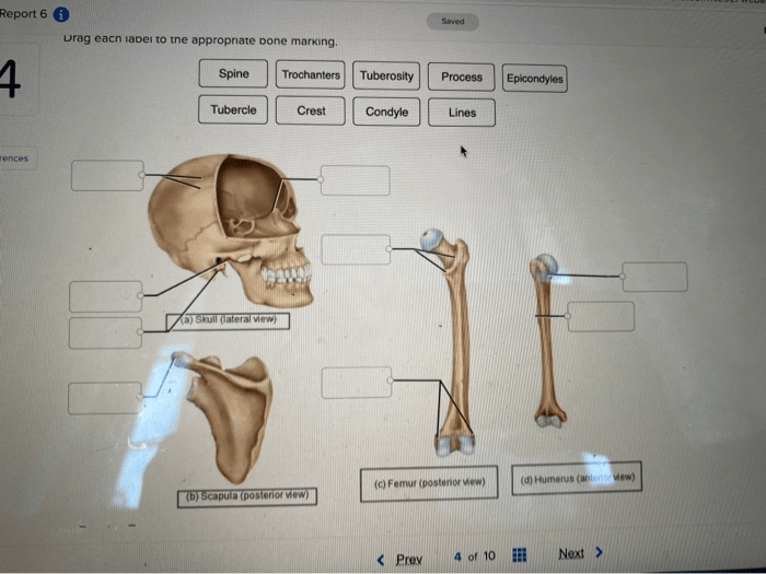 Drag each label to the appropriate bone marking